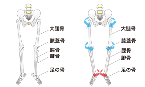 O脚の多くのパターン